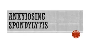 Understanding Ankylosing Spondylitis: Causes, Symptoms, and Treatment