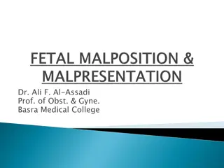 Fetal Malposition and Presentation in Obstetrics