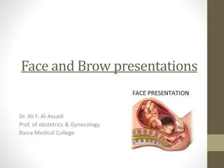 Face and Brow Presentations in Obstetrics & Gynecology