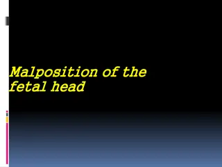 Occipito-Posterior Position of the Fetal Head