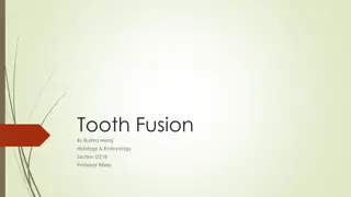 Tooth Fusion in Dentistry