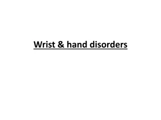 Understanding Wrist and Hand Disorders: Common Conditions and Symptoms