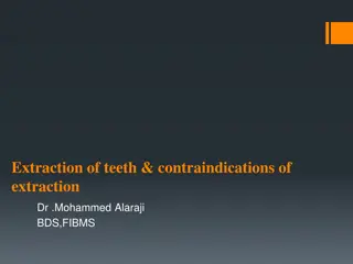 Overview of Tooth Extraction and Contraindications: Dr. Mohammed Alaraji