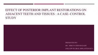 Effect of Posterior Implant Restorations on Adjacent Teeth and Tissues: A Case Control Study