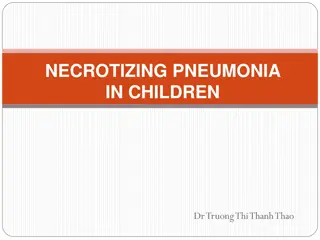 Overview of Necrotizing Pneumonia in Children