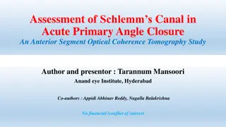 Assessment of Schlemm's Canal in Acute Primary Angle Closure: AS-OCT Study