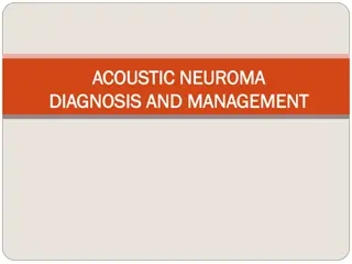 Acoustic Neuroma: Diagnosis and Management