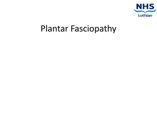 Understanding Plantar Fasciopathy: Causes, Symptoms, and Management