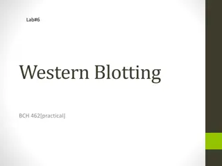 Western Blotting for Protein Detection in Biochemistry