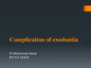 Common Complications of Exodontia in Dental Practice