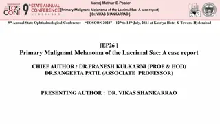 Primary Malignant Melanoma of the Lacrimal Sac: A Rare Case Report