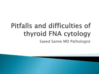 Insights on Reporting Thyroid Fine-Needle Aspiration as a Pathologist