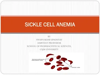 Sickle Cell Anemia: Causes, Symptoms, and Pathophysiology