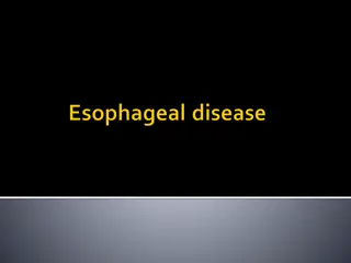 Approach to Dysphagia: Esophageal Cancer & Achalasia Cases