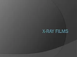 Understanding X-Ray Films: Composition and Classification