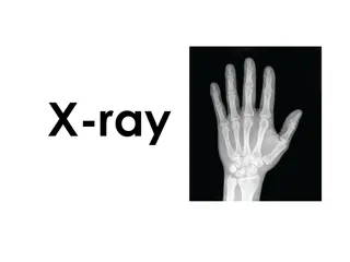 Exploring X-ray Imaging Technology in Healthcare