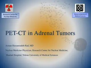 PET-CT Imaging in Adrenal Tumors at Tehran University