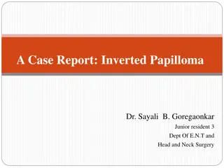 Inverted Papilloma Case Report and Diagnosis