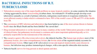 Understanding Tuberculosis: Causes, Transmission, and Control