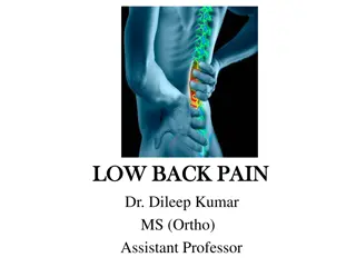 Low Back Pain: Causes, Epidemiology, and Management