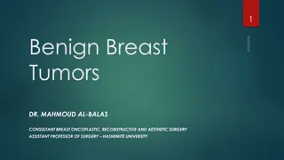 Understanding Fibroadenoma - A Benign Breast Tumor