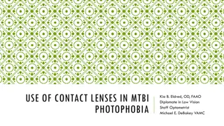 The Use of Contact Lenses in Photophobia Associated with mTBI