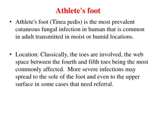 Athlete's Foot: Symptoms, Prevention, and Management