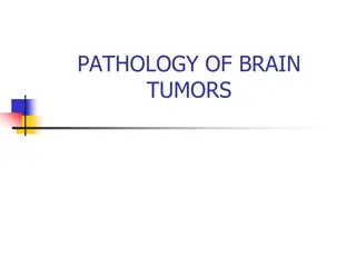 Epidemiology and Pathology of Brain Tumors - Overview and Incidence Statistics