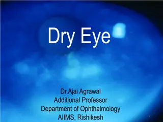 Dry Eye Disease: Causes, Symptoms, and Management