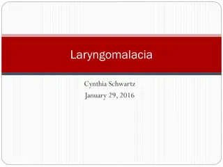 Laryngomalacia: Causes, Symptoms, and Management