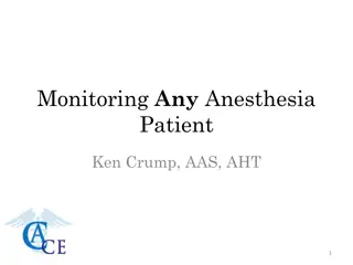 Understanding Fluid Bolus in Anesthesia Management