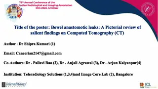 Bowel Anastomotic Leaks: Salient Findings on CT - Pictorial Review at IRIA 2023, Amritsar