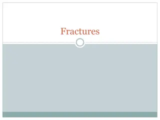 Different Types of Fractures and Their Characteristics