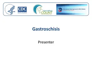 Gastroschisis: Clinical Features, Epidemiology, and Etiology