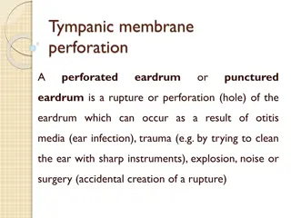 Understanding Tympanic Membrane Perforation: Causes, Symptoms, and Management