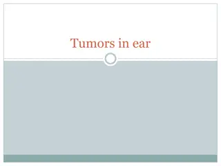 Ear Tumors and Cholesteatoma: Causes, Symptoms, and Management