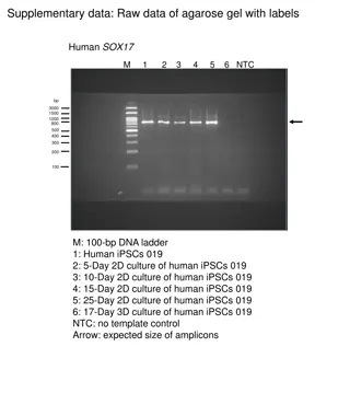 Raw Data of Agarose Gel for Human Gene Expression Analysis