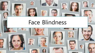 Face Blindness and its Impact on Recognition