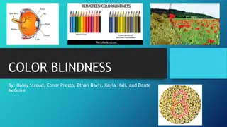 Color Blindness: Causes, Symptoms, and Types