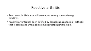 Reactive Arthritis: Symptoms, Diagnosis, and Treatment