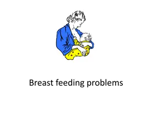 Breastfeeding Common Problems and Solutions