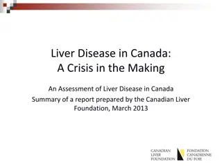 Liver Disease in Canada: An Assessment of the Current Situation