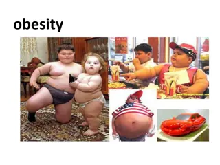 Childhood Obesity: Causes, Effects, and Management