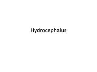 Understanding Hydrocephalus: Causes, Characteristics, and Impacts