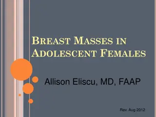 Breast Masses in Adolescent Females: Diagnosis and Management