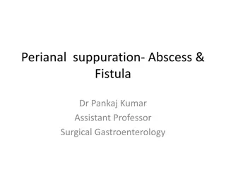 Perianal Suppuration: Abscess & Fistula Overview