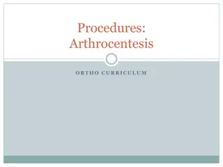 Guide to Arthrocentesis Procedure in Orthopedics