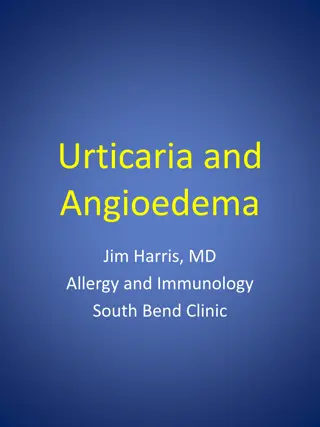 Understanding Urticaria and Angioedema: Symptoms, Causes, and Treatment