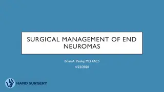 Surgical Management of End Neuromas - Overview and Treatment Options