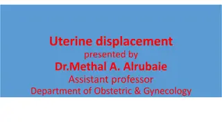 Understanding Uterine Displacement: Causes, Symptoms, and Treatment